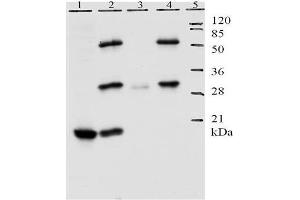 Lane 1 shows detection of E7 protein by Mab 8G6 in lysate of U20S cells. (Human Papilloma Virus 11 E7 (HPV-11 E7) (AA 1-35) anticorps)