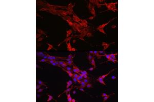 Immunofluorescence analysis of PC-12 cells using ST Rabbit pAb (ABIN6128541, ABIN6148581, ABIN6148582 and ABIN6213980) at dilution of 1:200 (40x lens).