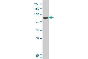 GPHN polyclonal antibody (A01), Lot # 060118JC01 Western Blot analysis of GPHN expression in Jurkat .