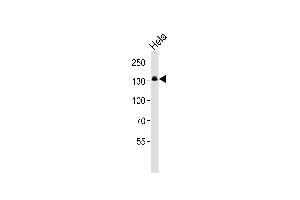 Western blot analysis of lysate from Hela cell line, using GTF2I Antibody at 1:1000. (GTF2I anticorps  (C-Term))
