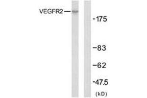 Western Blotting (WB) image for anti-VEGF Receptor 2 (VEGFR2) (AA 917-966) antibody (ABIN2889081) (VEGFR2/CD309 anticorps  (AA 917-966))
