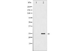 Western blot analysis of TNNI3 expression in Jurkat whole cell lysates,The lane on the left is treated with the antigen-specific peptide. (TNNI3 anticorps  (N-Term))