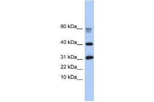 LOC339047 antibody used at 1 ug/ml to detect target protein. (LOC339047 anticorps  (Middle Region))