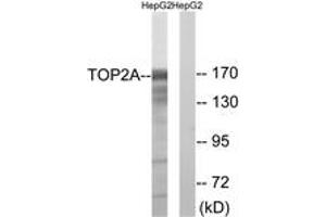 Western blot analysis of extracts from HepG2 cells, using TOP2A (Ab-1343) Antibody. (Topoisomerase II alpha anticorps  (AA 1311-1360))