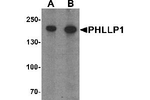 Western blot analysis of PHLPP1 in SW480 cell lysate with PHLPP1 antibody at (A) 1 and (B) 2 µg/mL. (PHLPP1 anticorps  (N-Term))