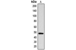 Western blot analysis of ARRDC1 expression in MDAMB231 (A) whole cell lysates. (ARRDC1 anticorps  (Center))