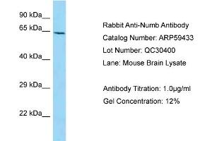 Western Blotting (WB) image for anti-Numb Homolog (NUMB) (C-Term) antibody (ABIN2788064) (NUMB anticorps  (C-Term))