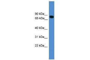 WB Suggested Anti-ITIH1 Antibody Titration: 0. (ITIH1 anticorps  (C-Term))