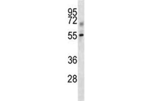 Tgfbr1 antibody western blot analysis in mouse kidney tissue lysate.