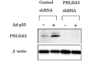 Western Blotting (WB) image for anti-Pleckstrin Homology-Like Domain, Family A, Member 3 (PHLDA3) (AA 1-31), (N-Term) antibody (ABIN2452076) (PHLDA3 anticorps  (N-Term))