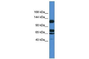 Western Blot showing ST5 antibody used at a concentration of 1. (ST5 anticorps  (Middle Region))