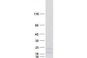 Validation with Western Blot