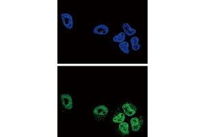 Immunofluorescence (IF) image for anti-Phospholipase A2, Group IVA (Cytosolic, Calcium-Dependent) (PLA2G4A) antibody (ABIN3003780)