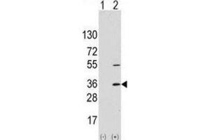 Western Blotting (WB) image for anti-Signal Sequence Receptor, alpha (SSR1) antibody (ABIN2997994)