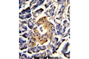 Immunohistochemistry (IHC) image for anti-Signal Recognition Particle 72kDa (SRP72) antibody (ABIN3002878)