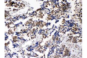 IHC analysis of Musashi 1/Msi1 using anti- Musashi 1/Msi1 antibody .