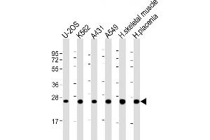 All lanes : Anti-UQCRFS1P1 Antibody (Center) at 1:2000 dilution Lane 1: U-2OS whole cell lysate Lane 2: K562 whole cell lysate Lane 3: A431 whole cell lysate Lane 4: A549 whole cell lysate Lane 5: human skeletal muscle lysate Lane 6: human placenta lysate Lysates/proteins at 20 μg per lane. (UQCRFS1P1 anticorps  (AA 71-104))