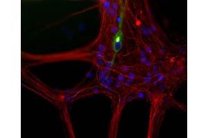 Mixed neuron/glia cultures from newborn rat brain stained with MCA-7C5 antibody to peripherin (green) and rabbit polyclonal antibody to NF-L ABIN1842266 (red channel). (NEFL anticorps)