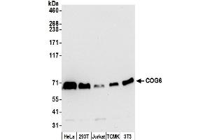 anti-Component of Oligomeric Golgi Complex 6 (COG6) (AA 607-657) antibody