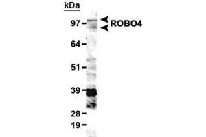 Western blot analysis of ROBO4 in HUVEC lysate with ROBO4 polyclonal antibody . (ROBO4 anticorps  (AA 900-1007))