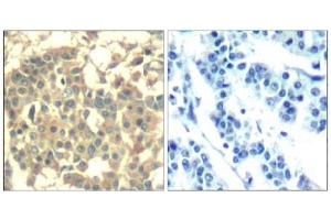 Image no. 2 for anti-Met Proto-Oncogene (MET) (AA 1001-1005) antibody (ABIN401653) (c-MET anticorps  (AA 1001-1005))