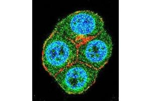 Confocal immunofluorescent analysis of BRTC1 Antibody (N-term)(Cat#AP50409PU-N) with ZR-75-1 cell followed by Alexa Fluor 488-conjugated goat anti-rabbit lgG (green).