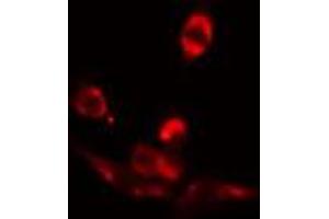 ABIN6272413 staining COLO205 by IF/ICC. (RFX3 anticorps  (C-Term))