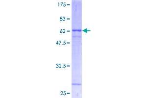 Image no. 1 for ATPase, Na+/K+ Transporting, beta 1 Polypeptide (ATP1B1) (AA 1-303) protein (GST tag) (ABIN1346023)