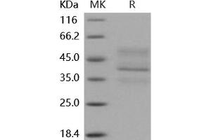 Western Blotting (WB) image for Tumor Necrosis Factor Receptor Superfamily, Member 17 (TNFRSF17) (Active) protein (His tag,Fc Tag) (ABIN7320451)