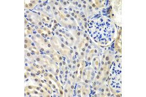 Immunohistochemistry of paraffin-embedded mouse kidney using SNRPD2 antibody at dilution of 1:100 (x40 lens). (SNRPD2 anticorps)