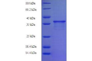 SDS-PAGE (SDS) image for Zinc Finger Protein 26 (ZNF26) (AA 335-533), (partial) protein (His-SUMO Tag) (ABIN5710652)