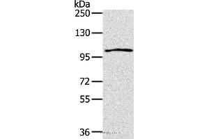 Western blot analysis of K562 cell, using IL17RA Polyclonal Antibody at dilution of 1:200 (IL17RA anticorps)