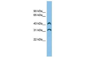 C3orf33 antibody used at 1 ug/ml to detect target protein. (C3orf33 anticorps  (Middle Region))