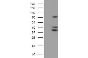 HEK293T cells were transfected with the pCMV6-ENTRY control (Left lane) or pCMV6-ENTRY CYP2B6 (Right lane) cDNA for 48 hrs and lysed.