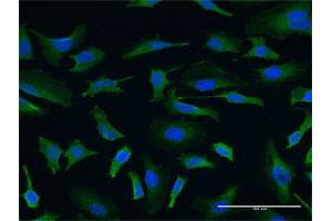 Immunofluorescence of monoclonal antibody to USP9X on HeLa cell. (USP9X anticorps  (AA 1-90))