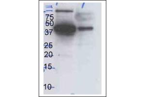Western Blotting (WB) image for anti-Mitogen-Activated Protein Kinase 1/3 (MAPK1/3) antibody (ABIN371670) (ERK1/2 anticorps)