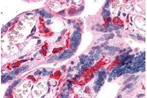Human Placenta: Formalin-Fixed, Paraffin-Embedded (FFPE) (HCLS1 anticorps  (AA 266-356))