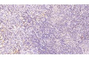 Detection of CD97 in Human Spleen Tissue using Monoclonal Antibody to Cluster Of Differentiation 97 (CD97)