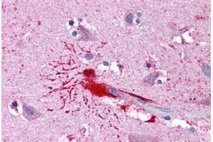 anti-LIM Homeobox 8 (LHX8) (AA 1-321) antibody