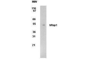 Image no. 1 for anti-Telomeric Repeat Binding Factor 2, Interacting Protein (TERF2IP) (AA 212-235) antibody (ABIN208205) (RAP1 anticorps  (AA 212-235))