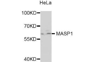 Western blot analysis of extracts of HeLa cells, using MASP1 antibody. (MASP1 anticorps)