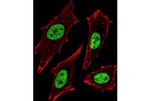 Fluorescent image of Hela cells stained with MGMT Antibody B. (MGMT anticorps)