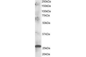 Image no. 1 for anti-ClpP Caseinolytic Peptidase, ATP-Dependent, Proteolytic Subunit Homolog (E. Coli) (CLPP) (C-Term) antibody (ABIN374308) (CLPP anticorps  (C-Term))