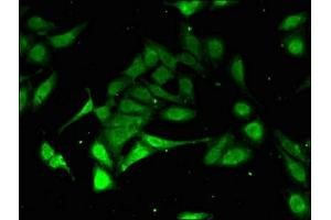 Immunofluorescent analysis of Hela cells using ABIN7164952 at dilution of 1:100 and Alexa Fluor 488-congugated AffiniPure Goat Anti-Rabbit IgG(H+L)