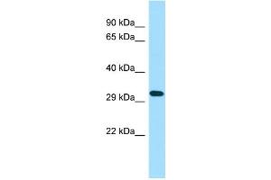 WB Suggested Anti-TAS2R50 Antibody Titration: 1.