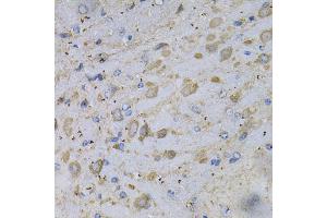 Immunohistochemistry of paraffin-embedded rat brain using GAD2 Antibody (ABIN5970359) at dilution of 1/100 (40x lens). (GAD65 anticorps)