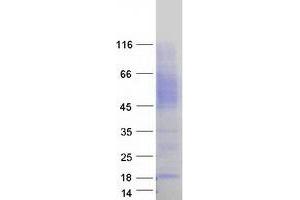 Validation with Western Blot