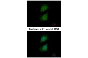 ICC/IF Image Immunofluorescence analysis of methanol-fixed HeLa, using Plexin D1, antibody at 1:500 dilution. (PLXND1 anticorps  (C-Term))