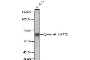 Western blot analysis of extracts of SH-SY5Y cells, using Cytokeratin 9 (KRT9) (KRT9) antibody (ABIN7268107) at 1:1000 dilution. (KRT9 anticorps)