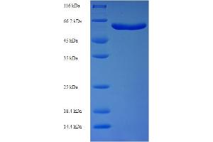 SDS-PAGE (SDS) image for Syntaphilin (SNPH) (AA 1-424), (partial) protein (His-SUMO Tag) (ABIN5710390)